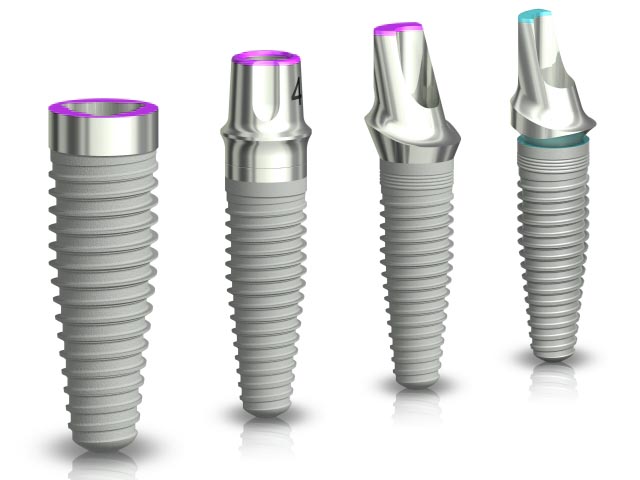 proceso-implantes-dentales