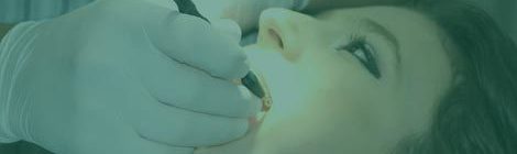 Implantes dentales y su integración osea